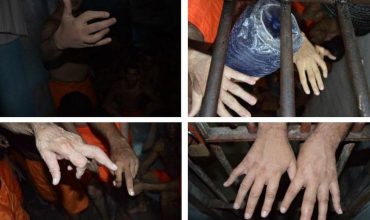 Tortura/dedos quebrados - Em relatório sobre missão ao estado do Ceará, imagem mostra mãos de diferentes presos com indícios de traumatismo nos dedos. Foto: Acervo do MNPCT (2019)